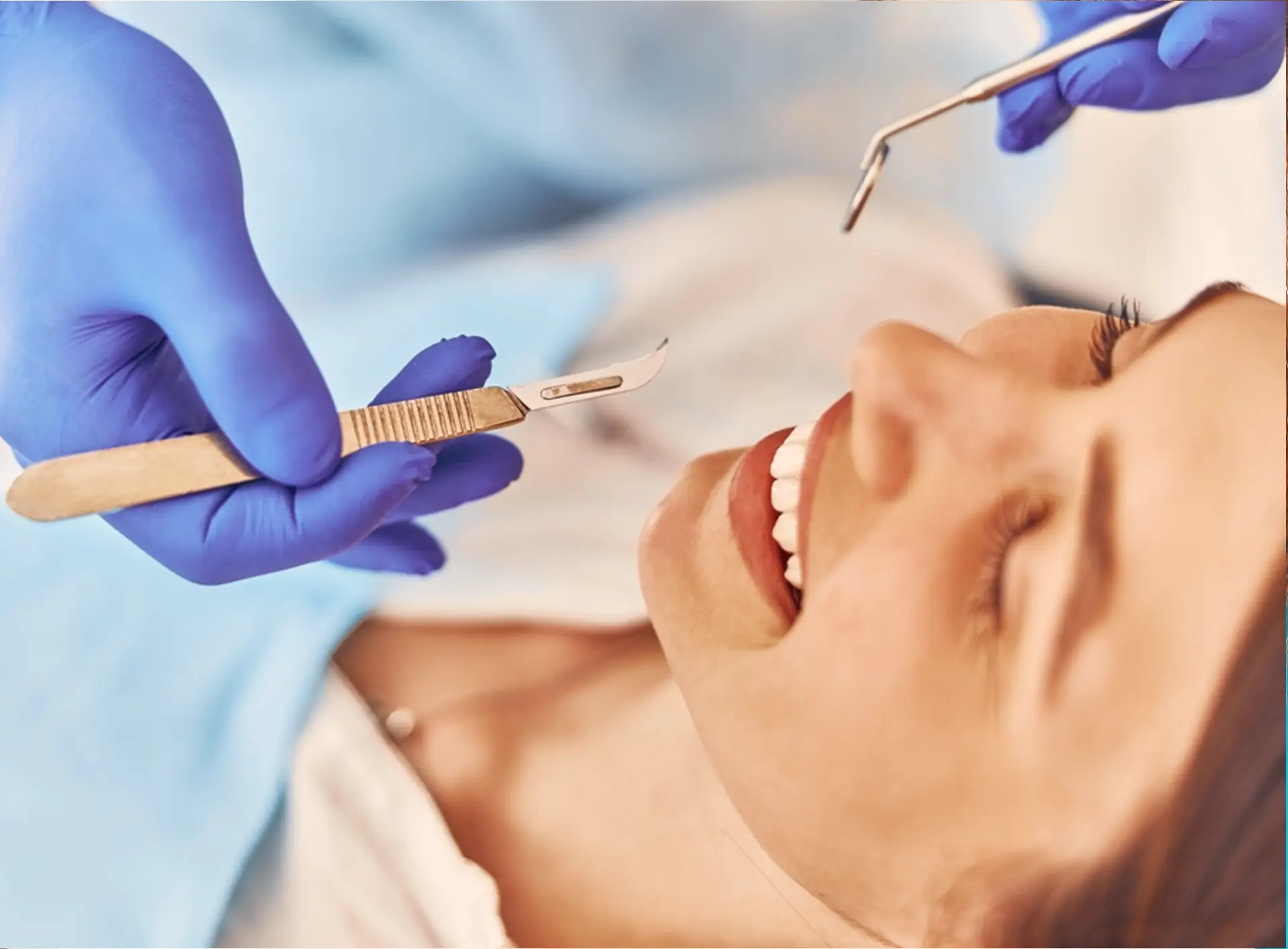Gingivectomie (esthétique des gencives)