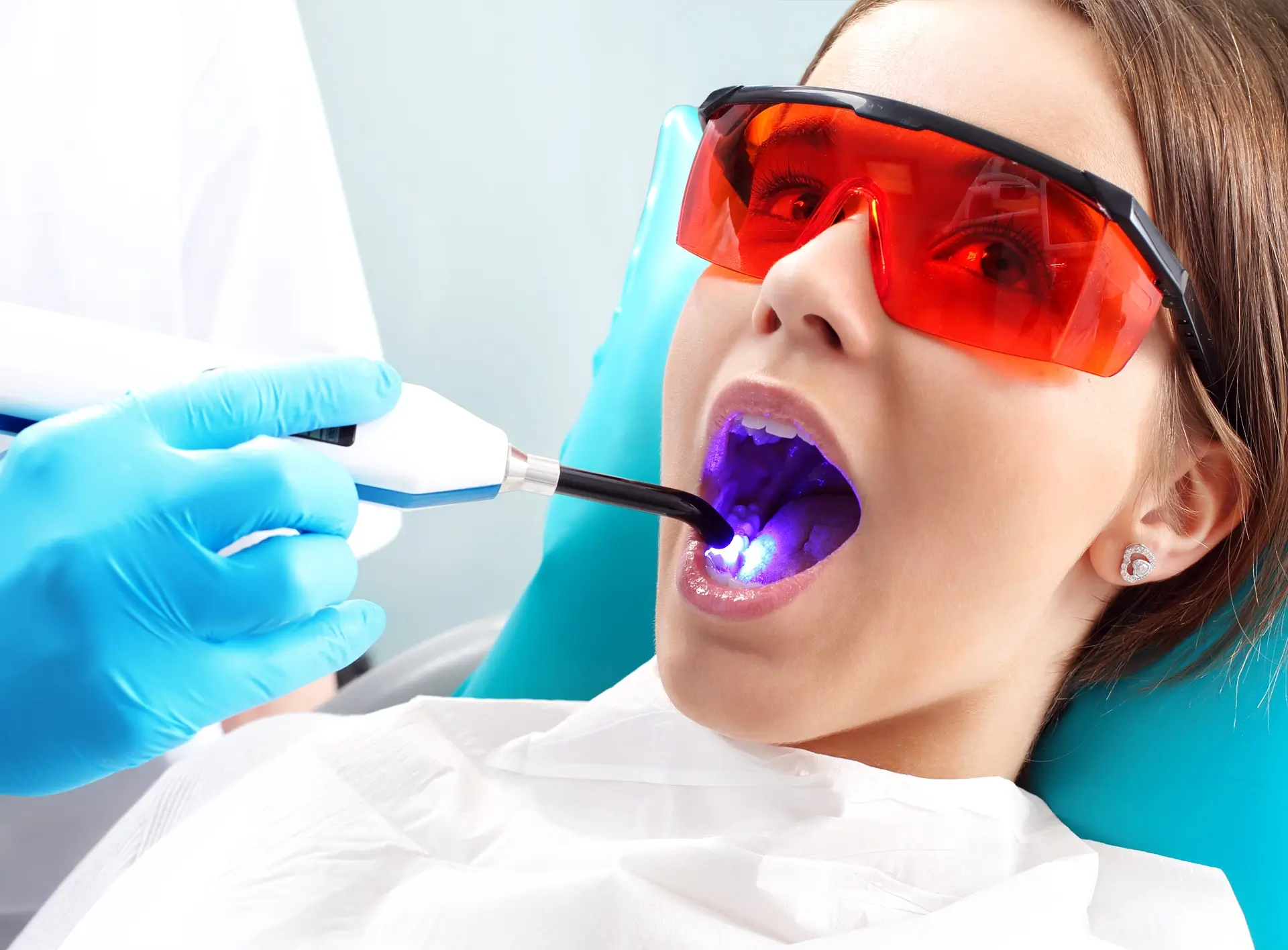 Laser dentaire / Dépigmentation